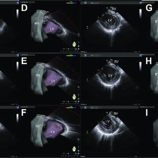 lv imaging photos